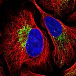 ZNF211 Polyclonal Antibody