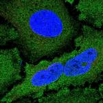 NCKIPSD Polyclonal Antibody
