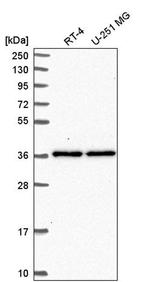 SHISA2 Antibody in Western Blot (WB)
