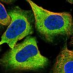 MIPOL1 Polyclonal Antibody