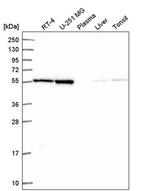 MIPOL1 Antibody in Western Blot (WB)