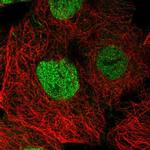 SPEN Polyclonal Antibody