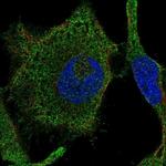 RAB42 Polyclonal Antibody