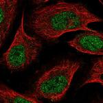 ZDBF2 Polyclonal Antibody