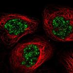 C11orf84 Antibody in Immunocytochemistry (ICC/IF)