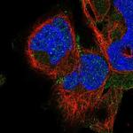 ADAM22 Polyclonal Antibody