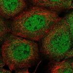 PIK3C2B Polyclonal Antibody