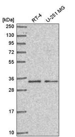 CCDC107 Antibody in Western Blot (WB)