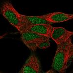 KRBA1 Polyclonal Antibody