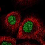 METTL1 Polyclonal Antibody