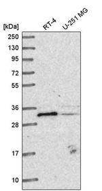 METTL1 Antibody in Western Blot (WB)