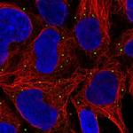 GNL1 Antibody in Immunocytochemistry (ICC/IF)