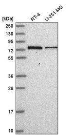 GNL1 Antibody in Western Blot (WB)