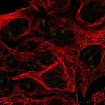 RPL7L1 Polyclonal Antibody