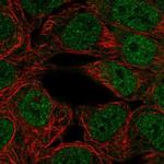 PPARGC1B Polyclonal Antibody