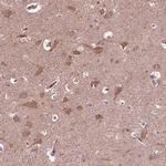 ZNF292 Antibody in Immunohistochemistry (IHC)