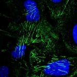 Septin-9 Polyclonal Antibody