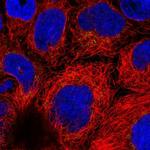 ARFRP1 Antibody in Immunocytochemistry (ICC/IF)