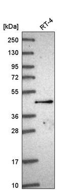 SLC35F2 Antibody in Western Blot (WB)