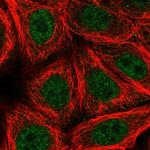 ZNF789 Polyclonal Antibody