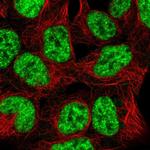 SNRPB2 Polyclonal Antibody