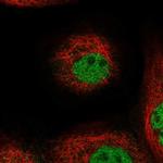 FAM179B Polyclonal Antibody