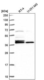 Histone Macro-H2A.1 Antibody in Western Blot (WB)
