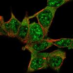 AKAP17A Polyclonal Antibody