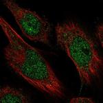 CAMTA2 Polyclonal Antibody