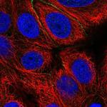 EFCAB11 Polyclonal Antibody