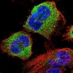 STK38L Polyclonal Antibody