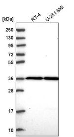THAP5 Antibody in Western Blot (WB)