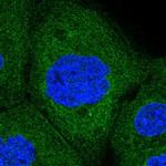 Ribophorin I Polyclonal Antibody