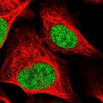 RAD54L Polyclonal Antibody