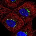 TMEM25 Polyclonal Antibody