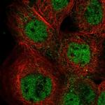 IKZF5 Polyclonal Antibody