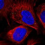 MAK10 Polyclonal Antibody