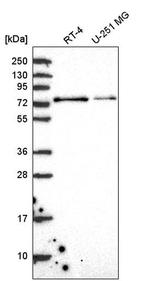 RC74 Antibody in Western Blot (WB)