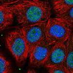 UBFD1 Polyclonal Antibody