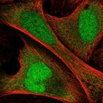 ANKRD36C Antibody in Immunocytochemistry (ICC/IF)