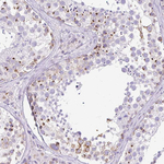 GOLGA8A Antibody in Immunohistochemistry (Paraffin) (IHC (P))