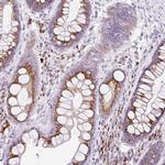GOLGA8A Antibody in Immunohistochemistry (IHC)