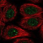 RAD51B Polyclonal Antibody