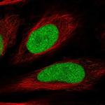 HIRIP3 Polyclonal Antibody