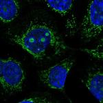 CCDC58 Polyclonal Antibody