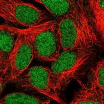 ALKBH2 Polyclonal Antibody