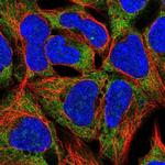 RPL19 Polyclonal Antibody