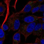 RAMP2 Polyclonal Antibody