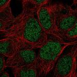 PRR14 Polyclonal Antibody