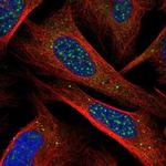 CHIC1 Polyclonal Antibody